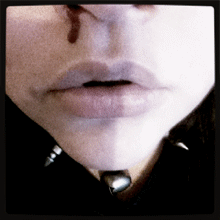 nose bleed